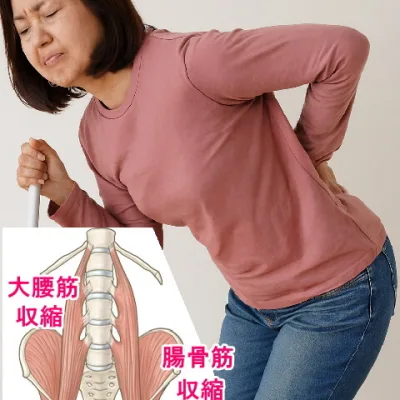 大腰筋、腸骨筋のバランス、収縮が原因でもある