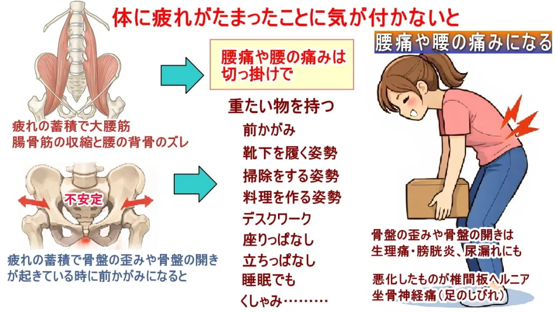 骨盤の歪みや骨盤の開き、背骨のズレから腰が痛くなる