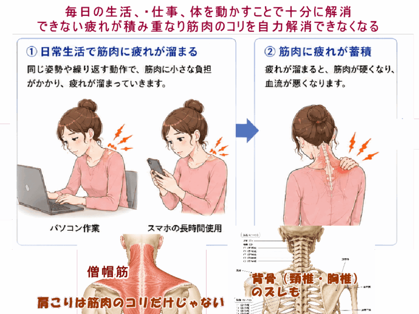 肩こりが起きるのは自力で筋肉のコリを解消できないから。北九州市・小倉の徳力整体院