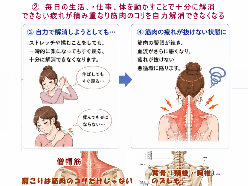 筋肉を運動、体操、ストレッチしても。北九州市・小倉の徳力整体院