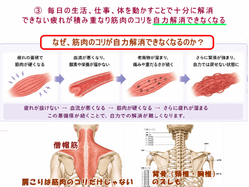 肩こりは筋肉の硬縮・結構不良。北九州市・小倉の徳力整体院