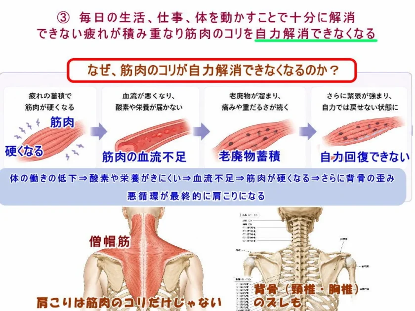 筋肉が硬くなると血行不良や老廃物がたまる。北九州市・小倉の徳力整体院。
