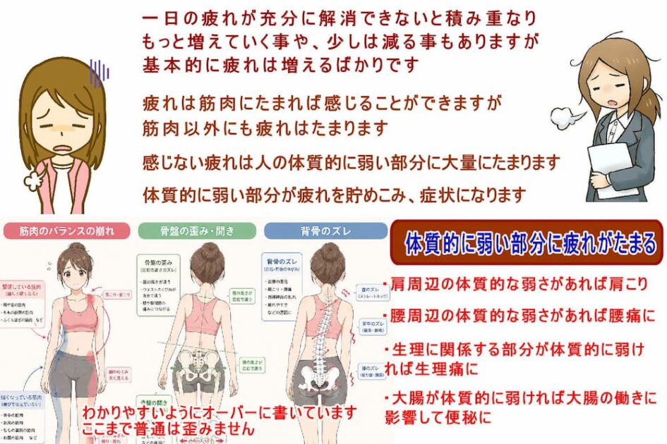 疲れは体質的に弱い部分に多くたまり、減らすことができないから、その部分の痛みやコリになる。北九州市・小倉の徳力整体院。