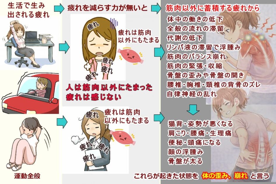日ごろに生み出される疲れの蓄積は人の体質的に弱い部分にたまって体の歪み、崩れになる、北九州市・小倉の徳力整体院。